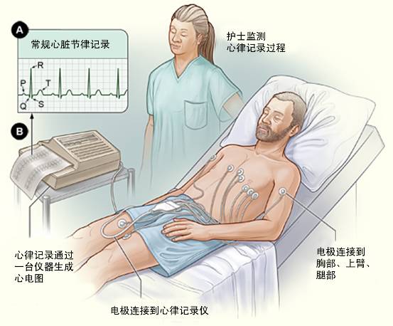 冠心病需要做哪些檢查？(圖1)